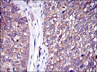 Immunohistochemistry-Paraffin: CBL Antibody (3B12) - BSA Free [NBP2-37574]