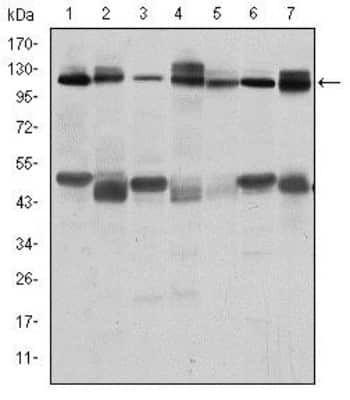 Western Blot: CBL Antibody (3B12)BSA Free [NBP2-37574]