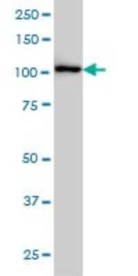 Western Blot: CBL Antibody (6D12) [H00000867-M01]