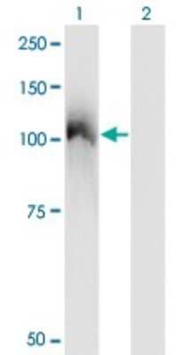 Western Blot: CBL Antibody (6D12) [H00000867-M01]