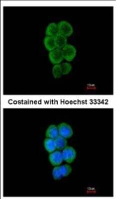 Immunocytochemistry/ Immunofluorescence: CBL Antibody [NBP2-15730]