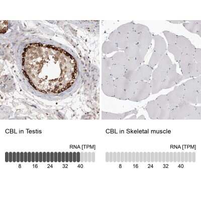 Immunohistochemistry-Paraffin: CBL Antibody [NBP1-86588]