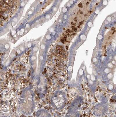 Immunohistochemistry-Paraffin: CBL Antibody [NBP1-86588]