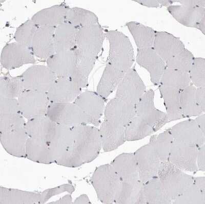 Immunohistochemistry-Paraffin: CBL Antibody [NBP1-86588]