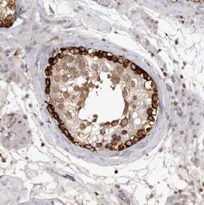 Immunohistochemistry-Paraffin: CBL Antibody [NBP1-86588]