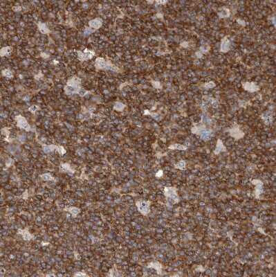 Immunohistochemistry-Paraffin: CBL Antibody [NBP1-86588]