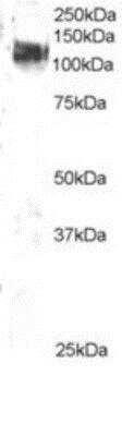 Western Blot: CBL Antibody [NB100-869]