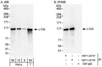 Western Blot: CBL Antibody [NBP1-28758]