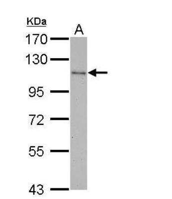 Western Blot: CBL Antibody [NBP2-15730]