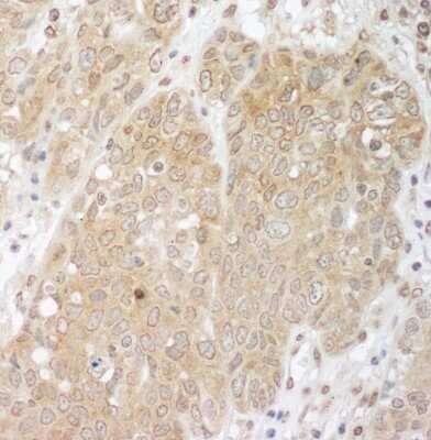 Immunohistochemistry-Paraffin: CBLB Antibody [NBP1-49919]