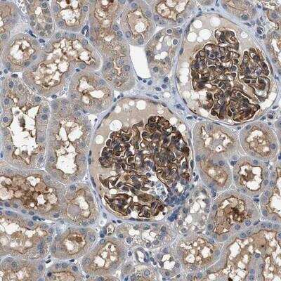 Immunohistochemistry: CBLB Antibody [NBP1-86601]