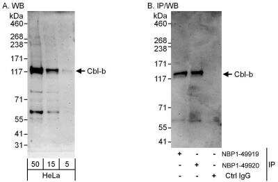 Western Blot: CBLB Antibody [NBP1-49920]