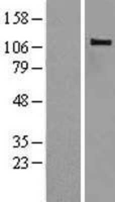 Western Blot: CBLB Overexpression Lysate [NBL1-08737]