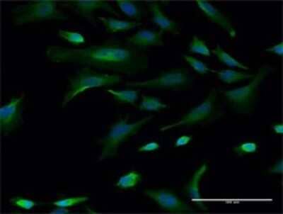 Immunocytochemistry/ Immunofluorescence: CBLL1 Antibody (3B12) [H00079872-M02]