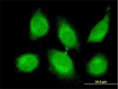 Immunocytochemistry/ Immunofluorescence: CBLL1 Antibody (4C2) [H00079872-M01]