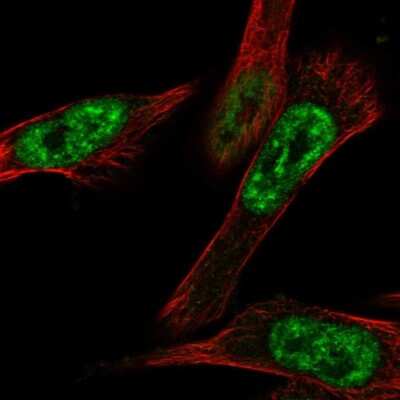 Immunocytochemistry/ Immunofluorescence: CBLL1 Antibody [NBP1-83588]