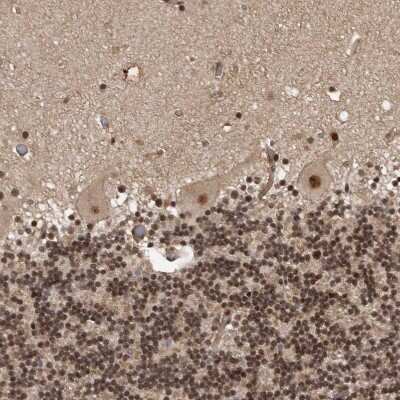 Immunohistochemistry-Paraffin: CBLL1 Antibody [NBP1-83588]