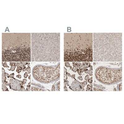 Immunohistochemistry-Paraffin: CBLL1 Antibody [NBP1-83588]