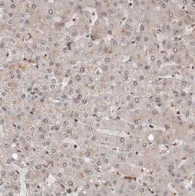 Immunohistochemistry-Paraffin: CBLL1 Antibody [NBP1-83588]