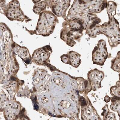 Immunohistochemistry-Paraffin: CBLL1 Antibody [NBP1-83588]