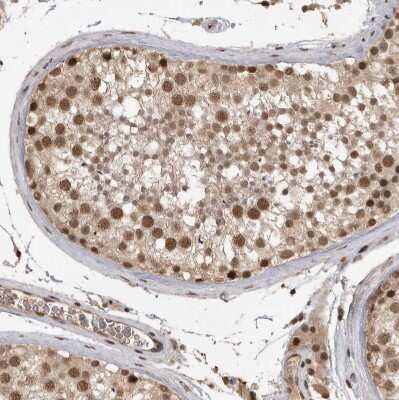 Immunohistochemistry-Paraffin: CBLL1 Antibody [NBP1-83588]