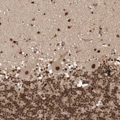 Immunohistochemistry-Paraffin: CBLL1 Antibody [NBP1-83589]