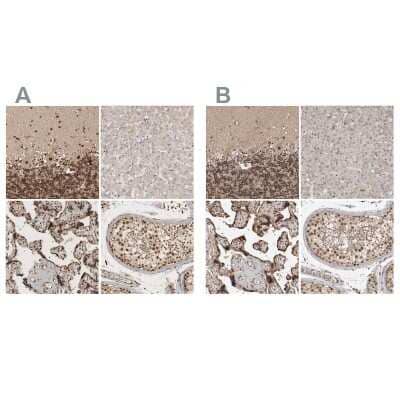 Immunohistochemistry-Paraffin: CBLL1 Antibody [NBP1-83589]