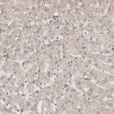 Immunohistochemistry-Paraffin: CBLL1 Antibody [NBP1-83589]