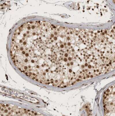 Immunohistochemistry-Paraffin: CBLL1 Antibody [NBP1-83589]