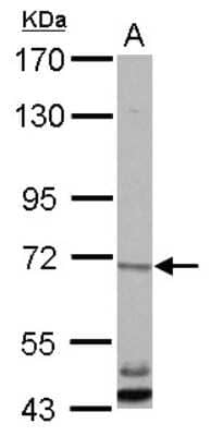 Western Blot: CBLL1 Antibody [NBP2-15731]