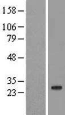 Western Blot: Cerebellin-2 Overexpression Lysate [NBL1-08740]