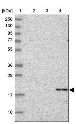 Western Blot: CBLN3 Antibody [NBP1-85844]