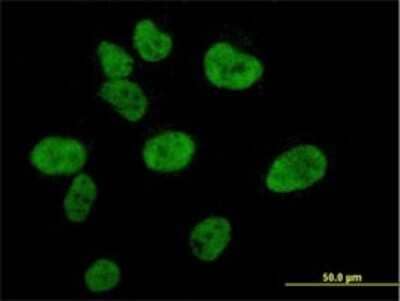 Immunocytochemistry/ Immunofluorescence: CBP/KAT3A Antibody (2H5) [H00001387-M01]