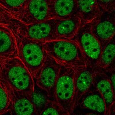 Immunocytochemistry/ Immunofluorescence: CBP/KAT3A Antibody [NBP2-38774]