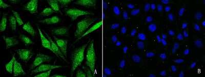 Immunocytochemistry/ Immunofluorescence: CBP/KAT3A Antibody [NBP2-98753]