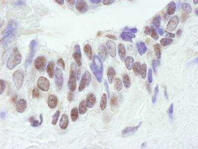 Immunohistochemistry: CBP/KAT3A Antibody [NB100-382]