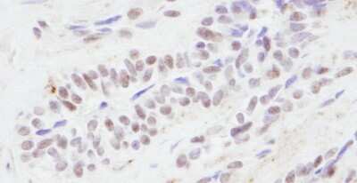 Immunohistochemistry: CBP/KAT3A Antibody [NB100-382]