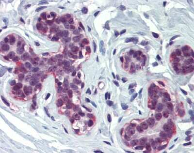 Immunohistochemistry: CBP/KAT3A Antibody [NBP1-52906]