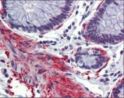 Immunohistochemistry-Paraffin: CBP/KAT3A Antibody [NBP1-52906]