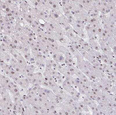 Immunohistochemistry-Paraffin: CBP/KAT3A Antibody [NBP2-38774]