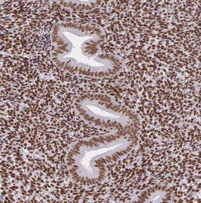 Immunohistochemistry-Paraffin: CBP/KAT3A Antibody [NBP2-38774]