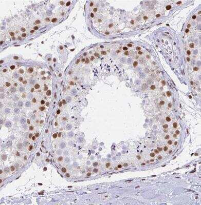 Immunohistochemistry-Paraffin: CBP/KAT3A Antibody [NBP2-38774]