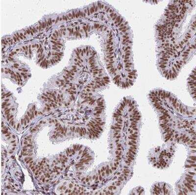 Immunohistochemistry-Paraffin: CBP/KAT3A Antibody [NBP2-38774]
