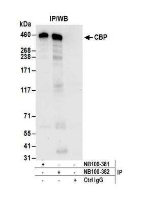 Immunoprecipitation: CBP/KAT3A Antibody [NB100-382]