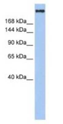 Western Blot: CBP/KAT3A Antibody [NBP1-52906]