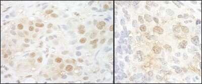 Immunohistochemistry-Paraffin: CBP20 Antibody [NBP1-30445]