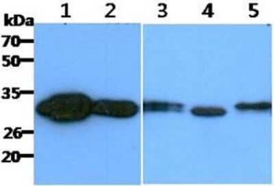 Western Blot: CBR1 Antibody (2D6)BSA Free [NBP2-59397]