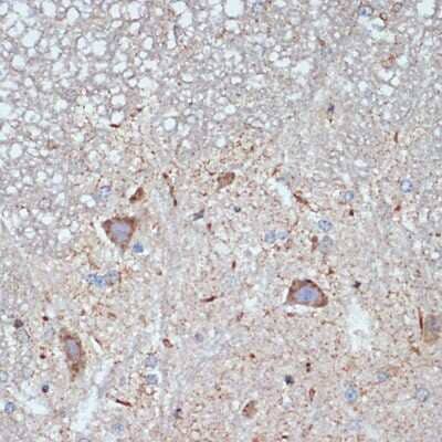 Immunohistochemistry-Paraffin: CBR1 Antibody (3A9O5) [NBP3-15724]