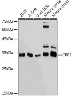 Western Blot: CBR1 Antibody (3A9O5) [NBP3-15724]