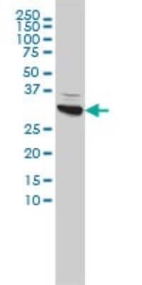 Western Blot: CBR1 Antibody (4D12-1G8) [H00000873-M02]